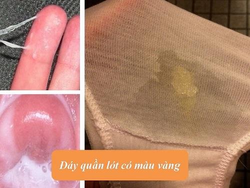 Đáy quần lót có màu vàng [Hé lộ bí mật khiến nữ giới bàng hoàng]