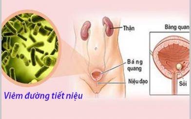Khám viêm đường tiết niệu ở đâu tốt nhất tại Hà Nội?