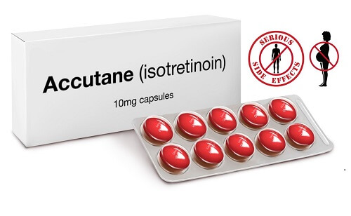 Isotretinoin (Accutane) điều trị mụn thịt dương vật hiệu quả
