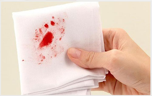 Đi ngoài ra máu tươi dính trên giấy vệ sinh