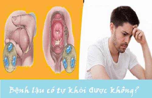 Bệnh lậu có thể phát hiện và chữa trị tại đâu?