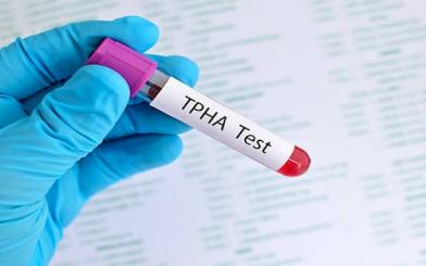 Xét nghiệm TPHA chẩn đoán giang mai có thật sự chính xác?
