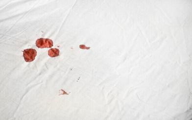 10 nguyên nhân quan hệ bị chảy máu và cách khắc phục