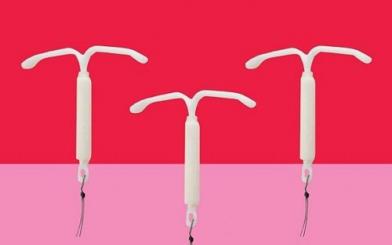 Vòng tránh thai (dụng cụ tử cung): Thông tin chi tiết về đặt và tháo vòng