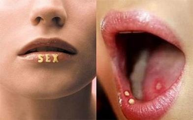 [ Giải Đáp ] Bệnh lậu có lây qua đường miệng hay không và chữa như nào ?