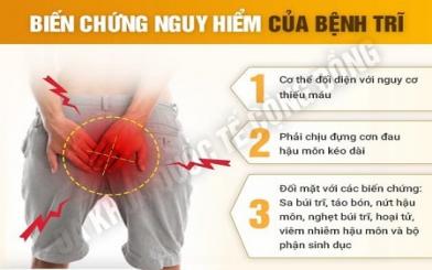 Những nguyên nhân chủ yếu gây ra bệnh trĩ ngoại mà ít người biết