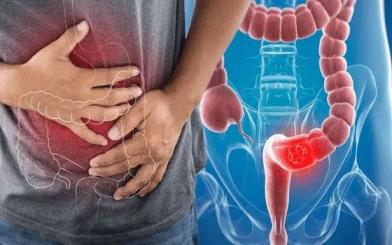 Bệnh rò hậu môn có nguy hiểm không? Cảnh báo 5 biến chứng dễ gặp