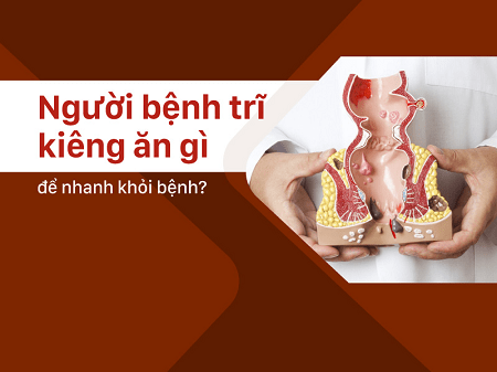 Bị trĩ ngoại kiêng ăn gì để tránh bệnh nặng thêm?