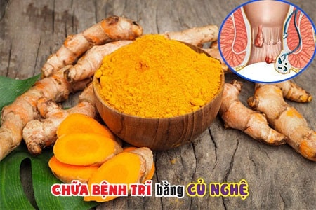 Nên hay không áp dụng các bài thuốc dân gian chữa bệnh trĩ ngoại tại nhà ?