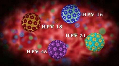 Các loại virus HPV phổ biến 