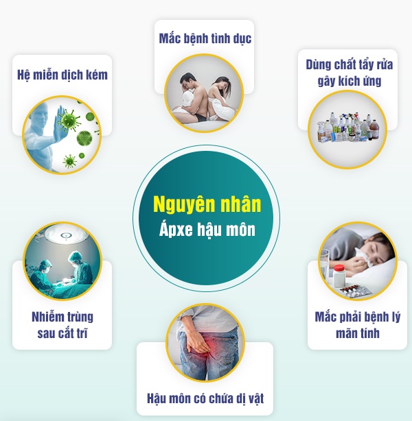 Vì sao cần biết cách phòng ngừa áp xe hậu môn?