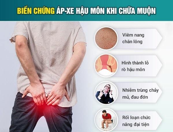 Áp xe hậu môn có mức độ nguy hiểm như thế nào ?