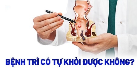 Liệu bệnh trĩ có tự khỏi được hay không?