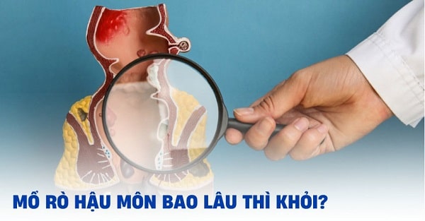 Liệu sau khi mổ rò hậu môn bao lâu thì khỏi?