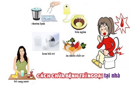 Biện pháp phòng ngừa bệnh trĩ ngoại độ 2 tại nhà