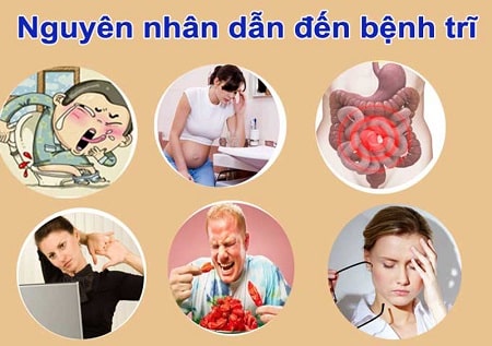 Bị trĩ ngoại nguyên nhân do đâu ?