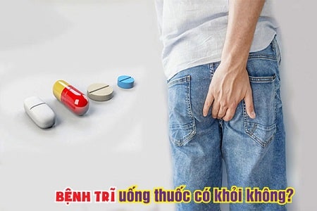 Bệnh trĩ nội uống thuốc có hết không ?