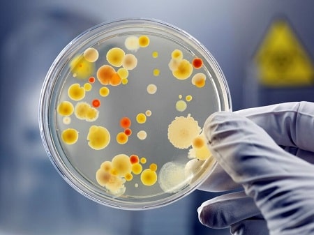 Hướng dẫn cách xét nghiệm vi khuẩn lậu