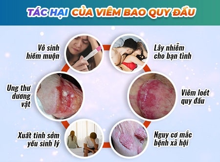 Viêm bao quy đầu có nguy hiểm không? Tác hại của bệnh lý là gì? 