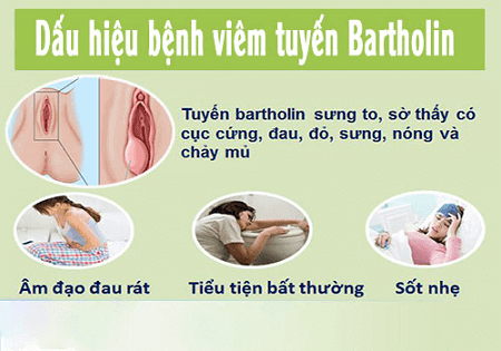 Dấu hiệu viêm tuyến Bartholin khi mang thai
