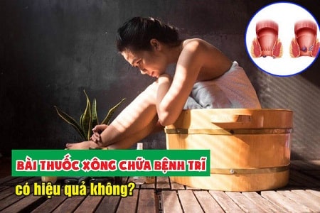 Bài thuốc xông trĩ ngoại có mang lại hiệu quả không ?